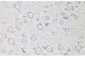 Immunohistochemistry of paraffin-embedded Rat brain using GANAB Polyclonal Antibody at dilution of 1:150 (40x lens). (GANAB Antikörper)