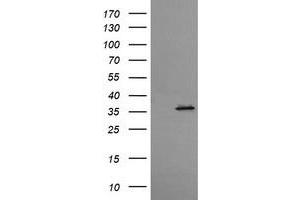 Western Blotting (WB) image for anti-T-cell surface glycoprotein CD1c (CD1C) antibody (ABIN2670671) (CD1c Antikörper)