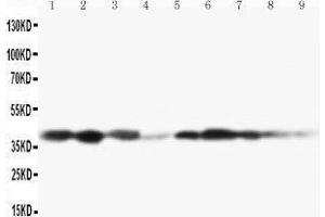 Lane 9: COLO320 Cell Lysate