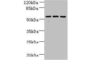 Western blot All lanes: ZNF19 antibody at 4 μg/mL Lane 1: Mouse liver tissue Lane 2: MDA-MB-231 whole cell lysate Lane 3: HepG2 whole cell lysate Secondary Goat polyclonal to rabbit IgG at 1/10000 dilution Predicted band size: 53, 52 kDa Observed band size: 53 kDa (ZNF19 Antikörper  (AA 1-200))