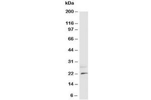 Western blot testing of NGF antibody and rat brain tissue lysate (Nerve Growth Factor Antikörper  (N-Term))