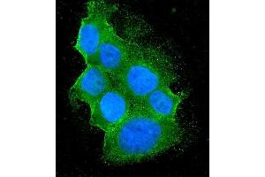 IF analysis of Bid using anti-Bid antibody (ABIN7599062). (BID Antikörper  (AA 1-195))