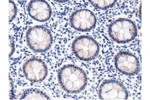 Immunohistochemical staining of paraffin-embedded Human colon tissue using anti-DNAJA2 mouse monoclonal antibody. (DNAJA2 Antikörper)