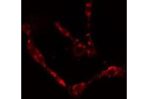 ABIN6277081 staining  HepG2 cells by IF/ICC. (NGFR Antikörper  (Internal Region))