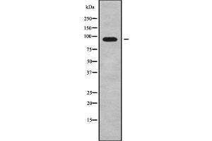 Western blot analysis of ADAM29 using COLO205 whole cell lysates (ADAM29 Antikörper  (C-Term))