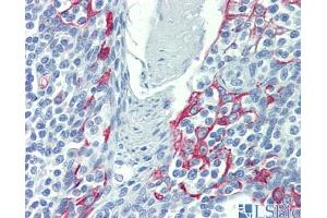 Immunohistochemistry (IHC) image for anti-LIM Domains Containing 1 (LIMD1) (N-Term) antibody (ABIN2784238)