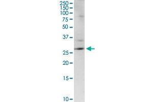 CENPH MaxPab rabbit polyclonal antibody. (CENPH Antikörper  (AA 1-247))