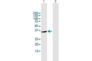 Western Blot analysis of MSX2 expression in transfected 293T cell line by MSX2 MaxPab polyclonal antibody. (Msx2/Hox8 Antikörper  (AA 1-267))