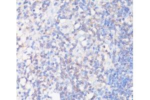 Immunohistochemistry of paraffin-embedded Human appendix using CFL1 Polyclonal Antibody at dilution of 1:100 (40x lens). (Cofilin Antikörper)