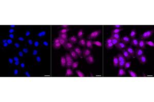 anti-PPP1CA + 1CB antibody