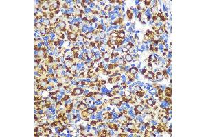 Immunohistochemistry of paraffin-embedded Rat ovary using FGF2 Rabbit pAb (ABIN3020744, ABIN3020745, ABIN3020746 and ABIN6213702) at dilution of 1:100 (40x lens). (FGF2 Antikörper  (AA 143-288))
