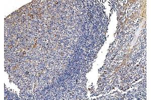 IHC analysis of GFPT1 using anti-GFPT1 antibody (ABIN7602887). (GFPT1 Antikörper  (C-Term))