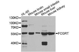 Western blot analysis of extracts of various cell lines, using FCGRT antibody (ABIN5995932) at 1/1000 dilution. (FcRn Antikörper)