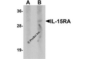 Western Blotting (WB) image for anti-Interleukin 15 Receptor, alpha (IL15RA) antibody (ABIN1077442)