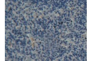 DAB staining on IHC-P; Samples: Rat Spleen Tissue (ABCB8 Antikörper  (AA 468-714))