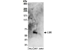 anti-Lipolysis Stimulated Lipoprotein Receptor (LSR) (AA 450-500) antibody
