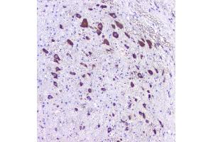 IHC analysis of 5HT2A Receptor using anti-5HT2A Receptor antibody (ABIN3042729).