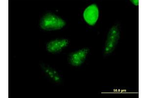 Immunofluorescence of monoclonal antibody to GCM1 on HeLa cell. (GCM1 Antikörper  (AA 108-166))