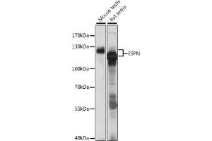 Western blot analysis of extracts of various cell lines, using ESPN antibody (ABIN7267008) at 1:1000 dilution. (Espin Antikörper  (AA 585-854))