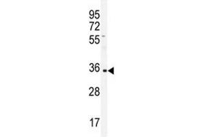 Western blot analysis of IGHA1 antibody and CEM lysate. (IGHA1 Antikörper  (AA 257-286))