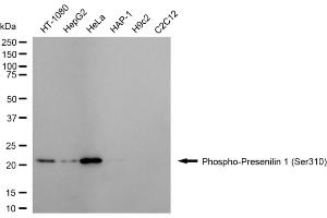Western blotting analysis using phospho-presenilin 1 (Ser310) antibody (ABIN7799896).