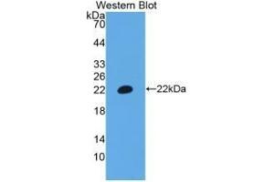 Detection of Recombinant CD3e, Human using Polyclonal Antibody to T-Cell Surface Glycoprotein CD3 Epsilon (CD3e) (CD3 epsilon Antikörper  (AA 28-185))