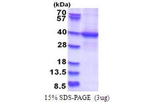 SDS-PAGE (SDS) image for STE20-Related Kinase Adaptor alpha (STRADA) (AA 1-314) protein (His tag) (ABIN5853758)