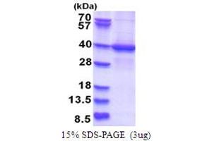 SDS-PAGE (SDS) image for STE20-Related Kinase Adaptor alpha (STRADA) (AA 1-314) protein (His tag) (ABIN5853758) (STRADA Protein (AA 1-314) (His tag))