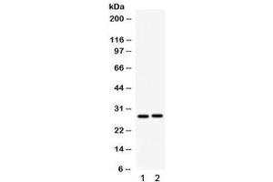 Western blot testing of 1) rat kidney and 2) mouse kidney lysate with IGFBP1 antibody. (IGFBPI Antikörper)