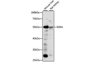 Western blot analysis of extracts of various cell lines, using RXRA antibody (ABIN6290900) at 1:1000 dilution.