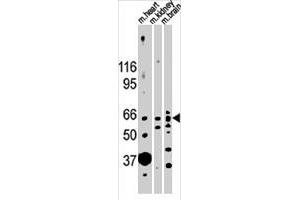 Western blot analysis of ACVR2B polyclonal antibody  in mouse heart, kidney and brain lysates (35 ug/lane). (ACVR2B Antikörper  (N-Term))