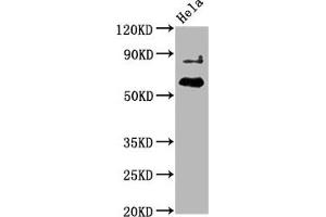 Western Blot Positive WB detected in Hela whole cell lysate All lanes Phospho-AKT1 antibody at 2. (Rekombinanter AKT1 Antikörper  (pThr450))