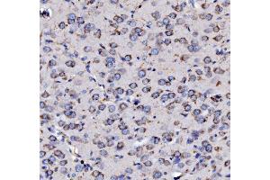 IHC analysis of MPPB/PMPCB using anti-MPPB/PMPCB antibody (ABIN7600758). (PMPCB Antikörper  (AA 23-479))