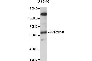 Western blot analysis of extracts of U-87MG cells, using PPP2R5B antibody (ABIN6293293) at 1:1000 dilution.