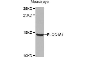 Western blot analysis of extracts of mouse eye, using BLOC1S1 Antibody (ABIN5975442) at 1/1000 dilution. (BLOC1S1 Antikörper)