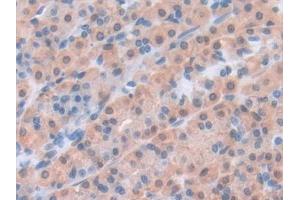 Immunohistochemistry (IHC) image for anti-Leptin (LEP) (AA 22-167) antibody (ABIN7429181)