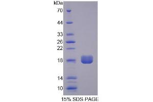SDS-PAGE analysis of Human PPAP2B Protein.