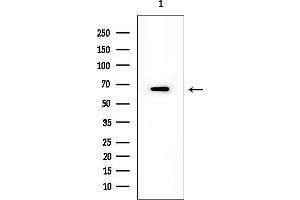 Western blot analysis of lysates from EC304 cells, using HOMEZ Mouse Monoclonal Antibody at 1/1000 dilution.