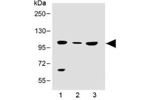 Western blot testing of human 1) 293T/17, 2) brain and 3) K562 lysate with SLC14A2 antibody at 1:500. (Solute Carrier Family 14 (Urea Transporter, Kidney) Member 2 (SLC14A2) (AA 42-76) Antikörper)