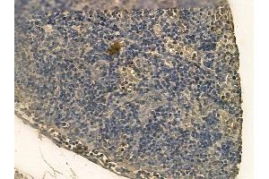 KIAA0100 Mouse Monoclonal Antibody at 1/100 staining rat pancreatic tissue by IHC-P. (KIAA0100/BCOX1 Antikörper)