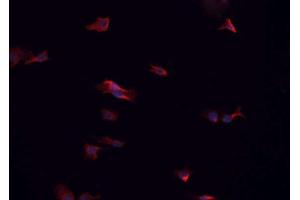 ABIN6266575 staining HeLa cells by IF/ICC. (Cytokeratin 7 Antikörper  (C-Term))