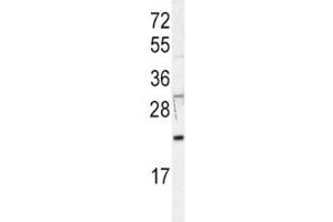 Western blot analysis of HRAS antibody in Jurkat lysate. (HRAS Antikörper  (AA 104-128))