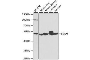 Western blot analysis of extracts of various cell lines, using SETD6 antibody. (SETD6 Antikörper  (AA 301-473))