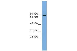 WB Suggested Anti-ARHGEF19 Antibody Titration: 0. (ARHGEF19 Antikörper  (Middle Region))