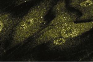 Immunofluorescent staining of HISM cells. (Smad2/3 Antikörper  (AA 142-263))