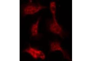 Immunofluorescence (fixed cells) (IF/ICC) image for anti-Ezrin (EZR) (pTyr146) antibody (ABIN6256643)
