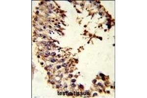 Formalin-fixed and paraffin-embedded human testis tissue reacted with ACR Antibody (Center), which was peroxidase-conjugated to the secondary antibody, followed by DAB staining. (Acrosin Antikörper  (AA 99-127))