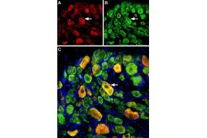 Multiplex staining of ASIC1 and ASIC3 in rat DRG - Immunohistochemical staining of perfusion-fixed frozen rat dorsal root ganglia (DRG) sections using Guinea pig Anti-ASIC1 Antibody (ABIN7042914, ABIN7045410 and ABIN7045411), (1:400) and rabbit Anti-ASIC3 Antibody (ABIN7042917, ABIN7045243 and ABIN7045244), (1:400). (ASIC3 Antikörper  (Intracellular, N-Term))