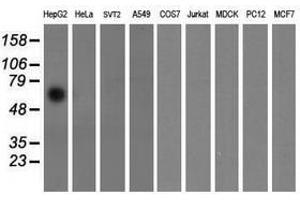 Image no. 2 for anti-Formiminotransferase Cyclodeaminase (FTCD) antibody (ABIN1496382) (FTCD Antikörper)