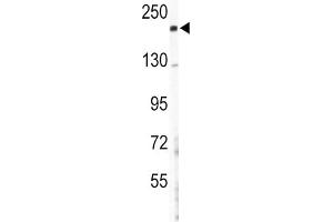 Western Blotting (WB) image for anti-Collagen, Type V, alpha 2 (COL5A2) antibody (ABIN3003163)